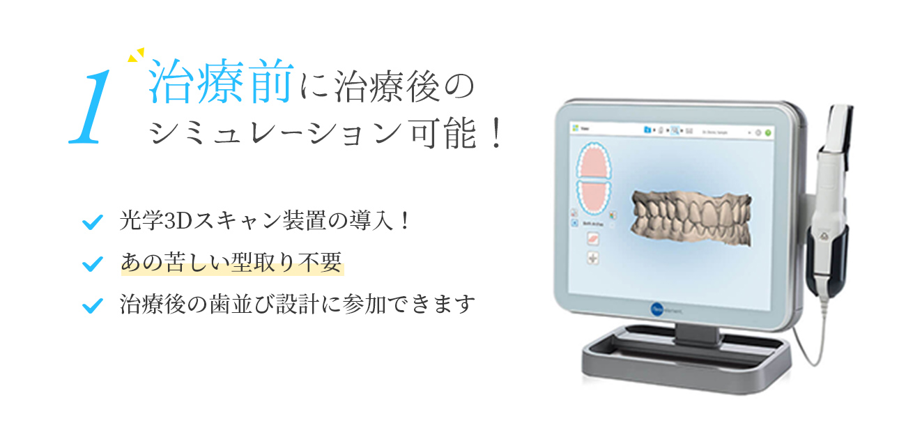 1 治療前に治療後のシミュレーション可能！