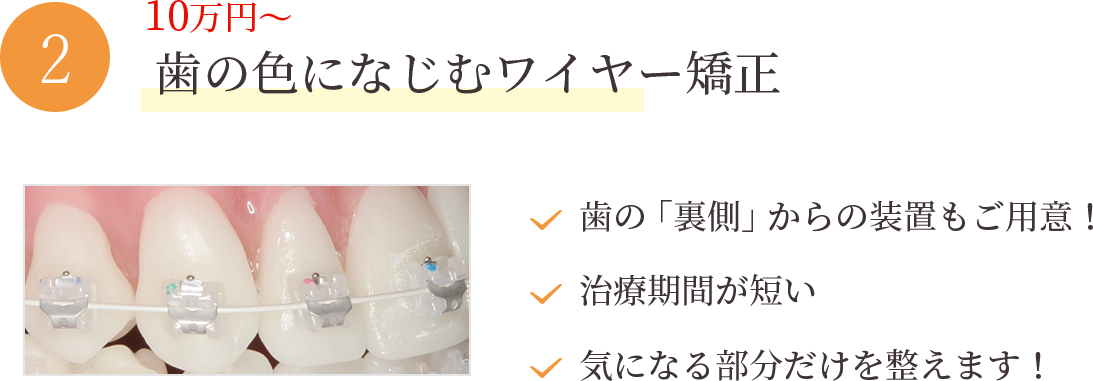 歯の色になじむワイヤー矯正